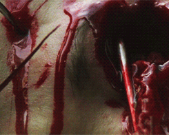 1.Ici.gif