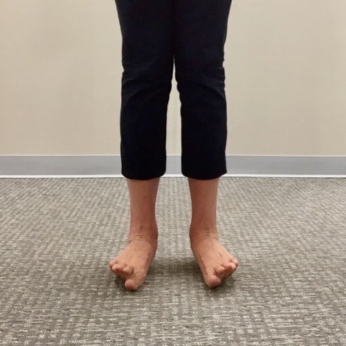 Select Chiropractic and Wellness — Foot Drills