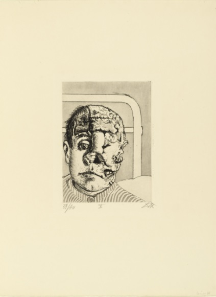 Skin Graft (Transplantation) from The War (Der Krieg) (1924)