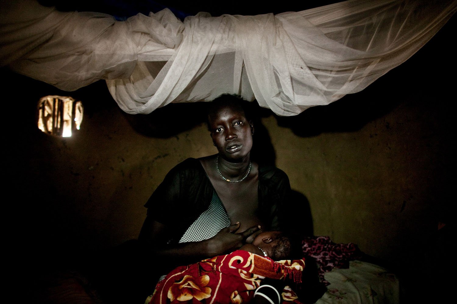 A survivor of a recent massacre in Fangak, southern Sudan on Thursday, April 7, 2011. The massacre occurred when forces loyal to rebel General George Athor attacked the to town of Fangak on Feb 9th and 10th, 2011. When the fighting ended, more than 