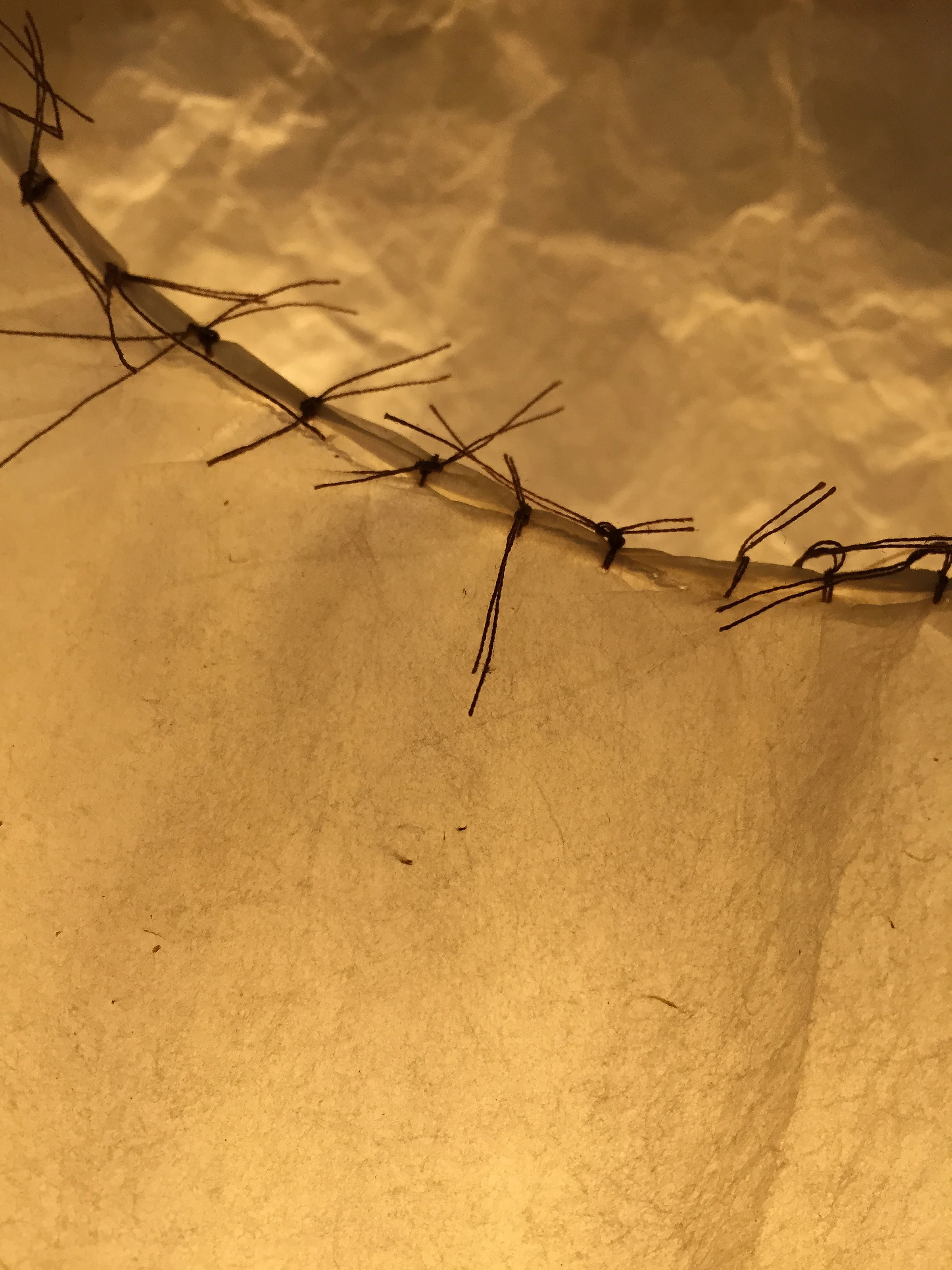 WrittenOnBody_SutureArmhole copy.jpg