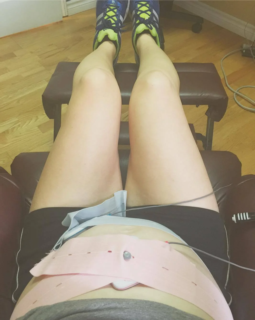 Fetal Non-Stress Test (NST)