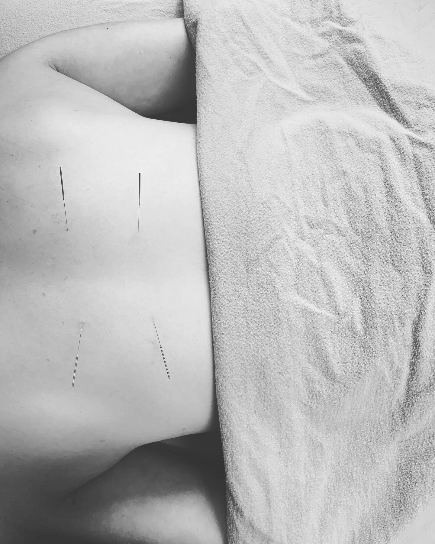 Wildcrafted Acupuncture & Herbs