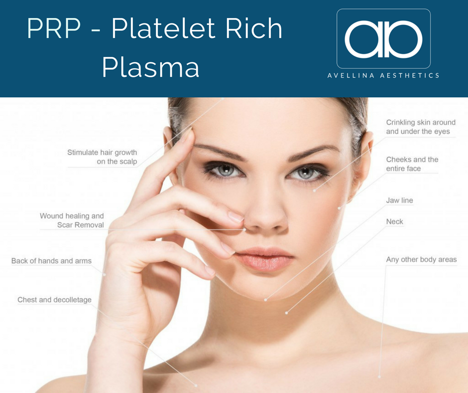 Platelet Rich Plasma - Royal PRP Facelift - Avellina Aesthetics