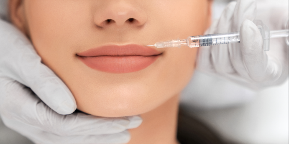 Lip Filler Aftercare: Essential Tips and What to Avoid