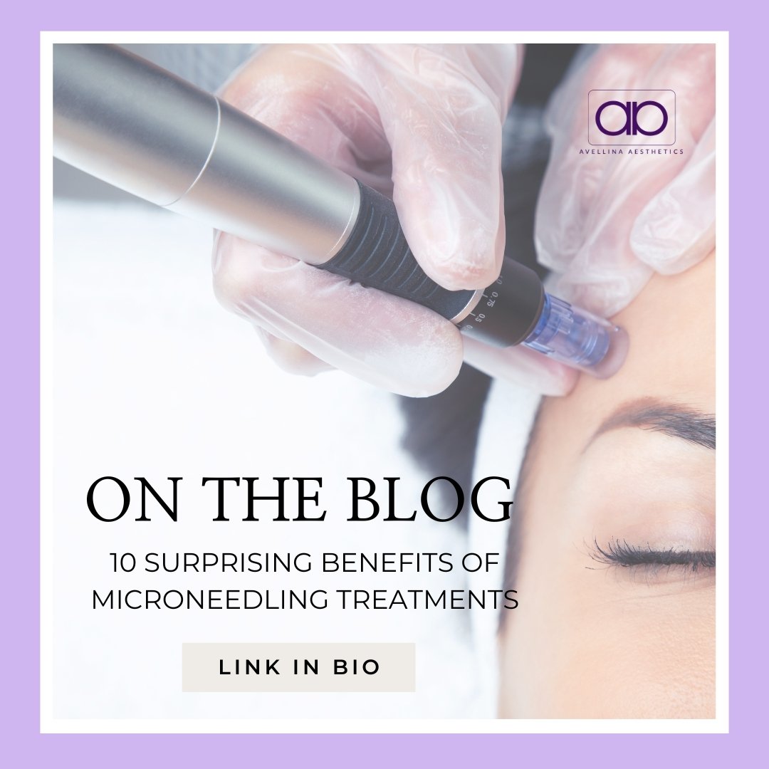 Check out our latest blog post: &quot;10 Surprising Benefits of Microneedling Treatments&quot;! 🌟

Discover the incredible advantages that microneedling can offer beyond just skin rejuvenation. From promoting collagen production to reducing the appe