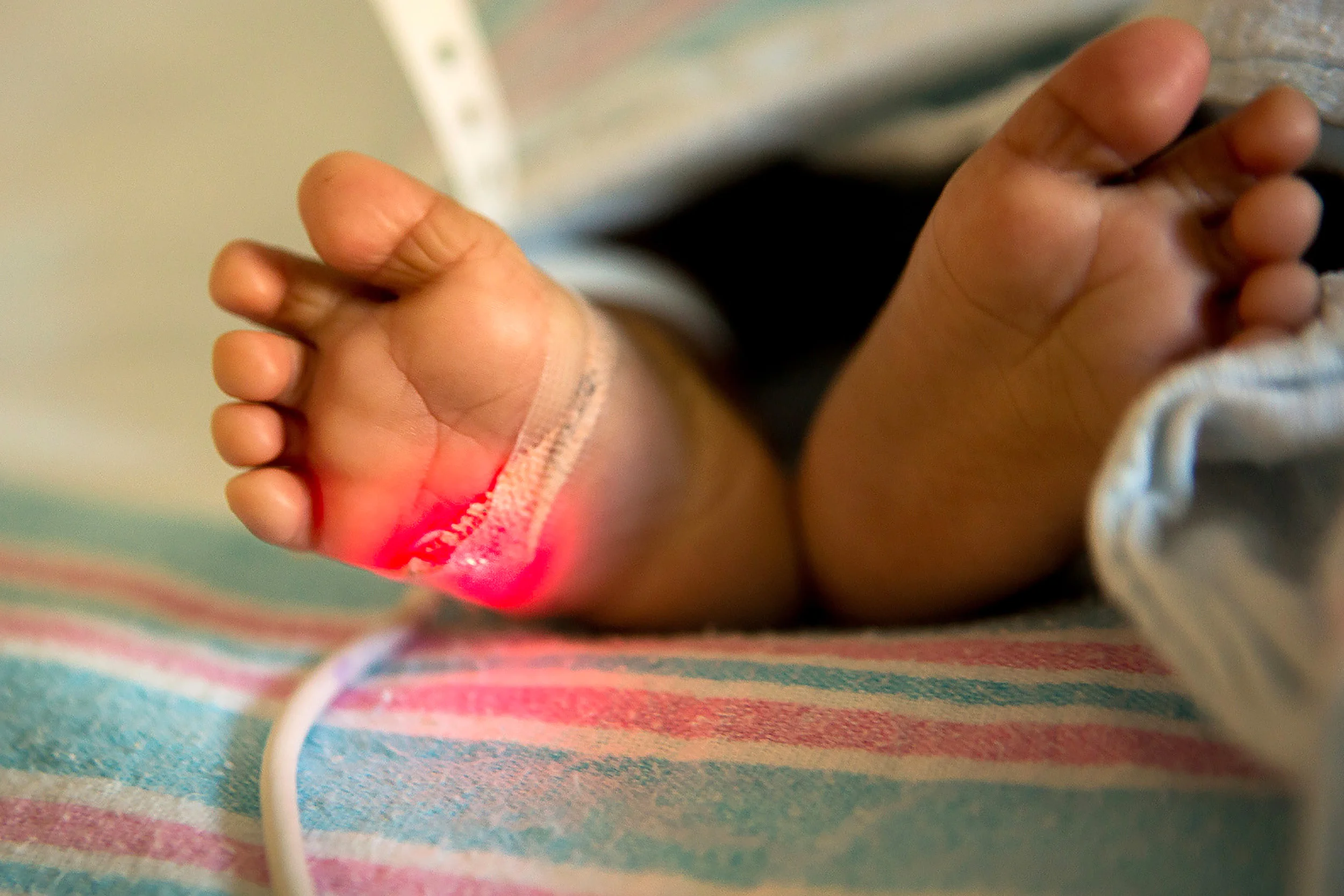 Closeup of child's toe in a medical setting