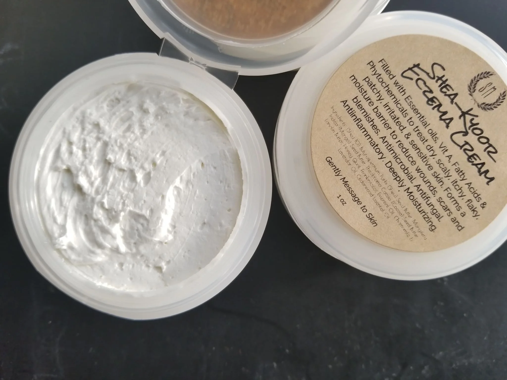 eczemma1.jpg