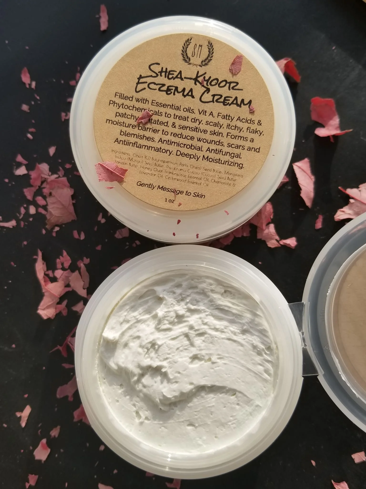 eczema4.jpg