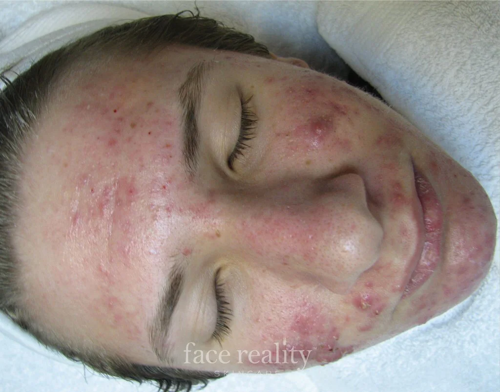 Face Reality Skin Care Maine Laser and Aesthetics,LLC,PA Dr