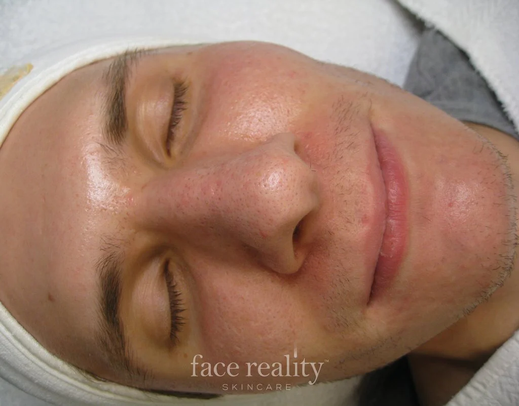 Face Reality Skin Care Maine Laser and Aesthetics,LLC,PA Dr
