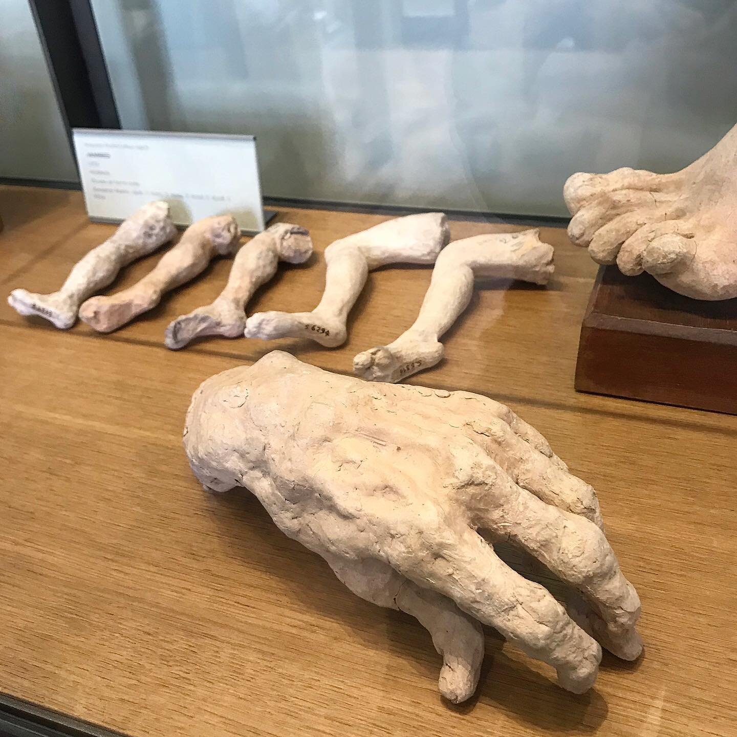 Ok, one more limb-thing from Rodin @museerodinparis Disembodied heads, hands, feet, arms and other parts had been stockpiled by the hundreds over the years, providing the sculptor with a wealth of poses and expressions that he could literally take of