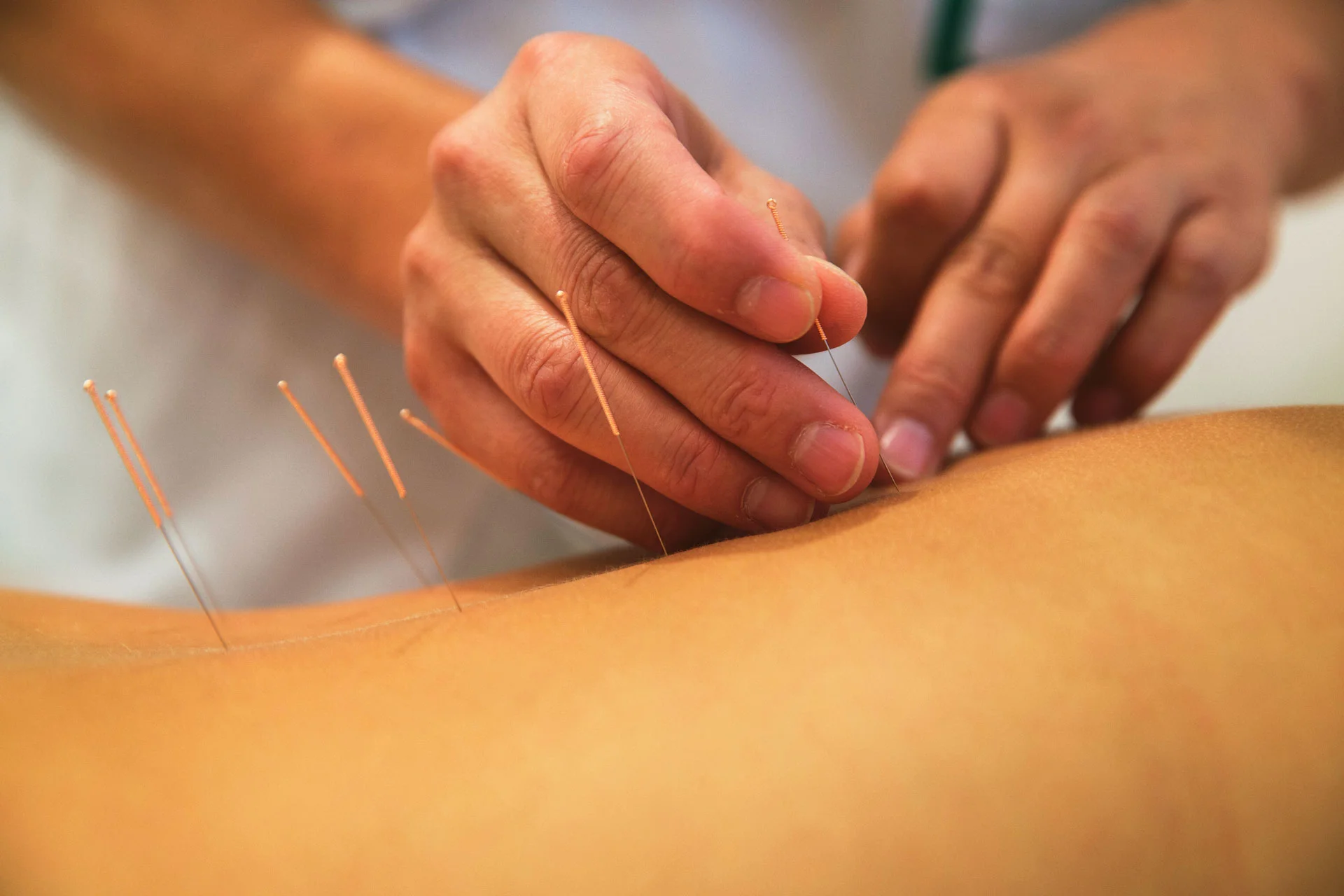 web-acupuncture.jpg