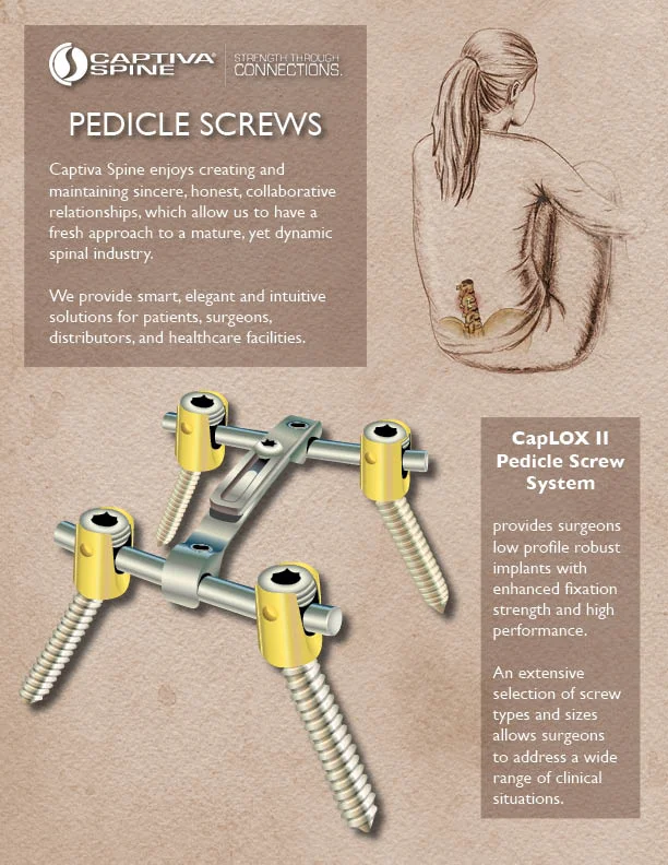 Pedicle Screws