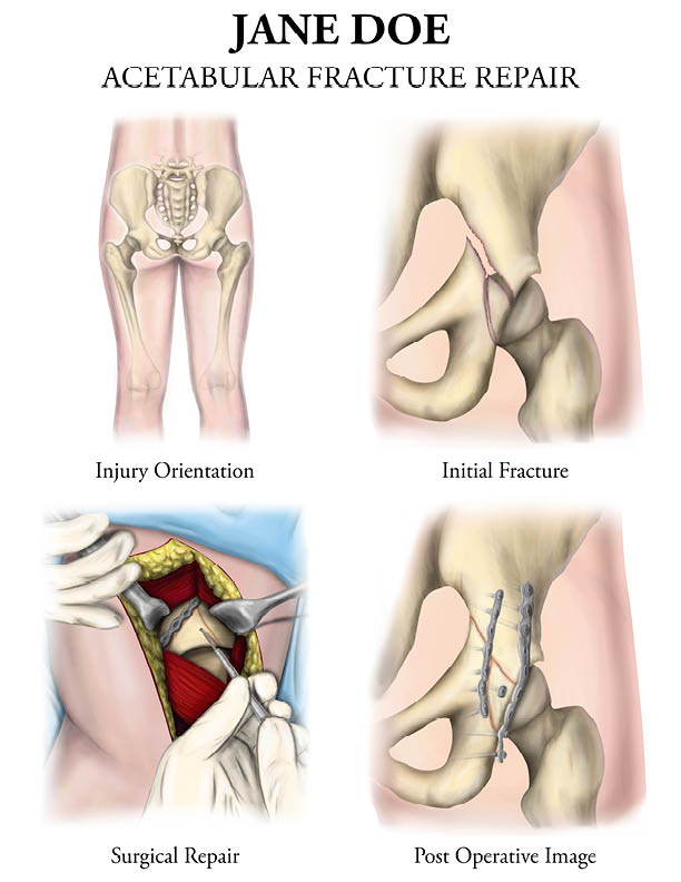 Medical Legal Exhibit