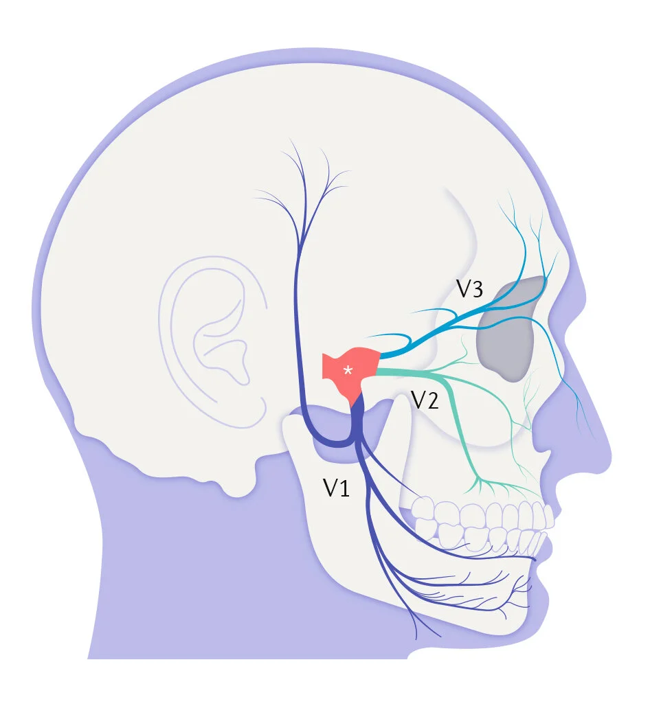 J Vallis Skull.jpg