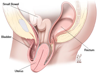 Strenbodi Pelvic Support Belt Uterus Support Belt Women's Brace for  Treating Dropped Bladder Uterine Prolapse Vulvar