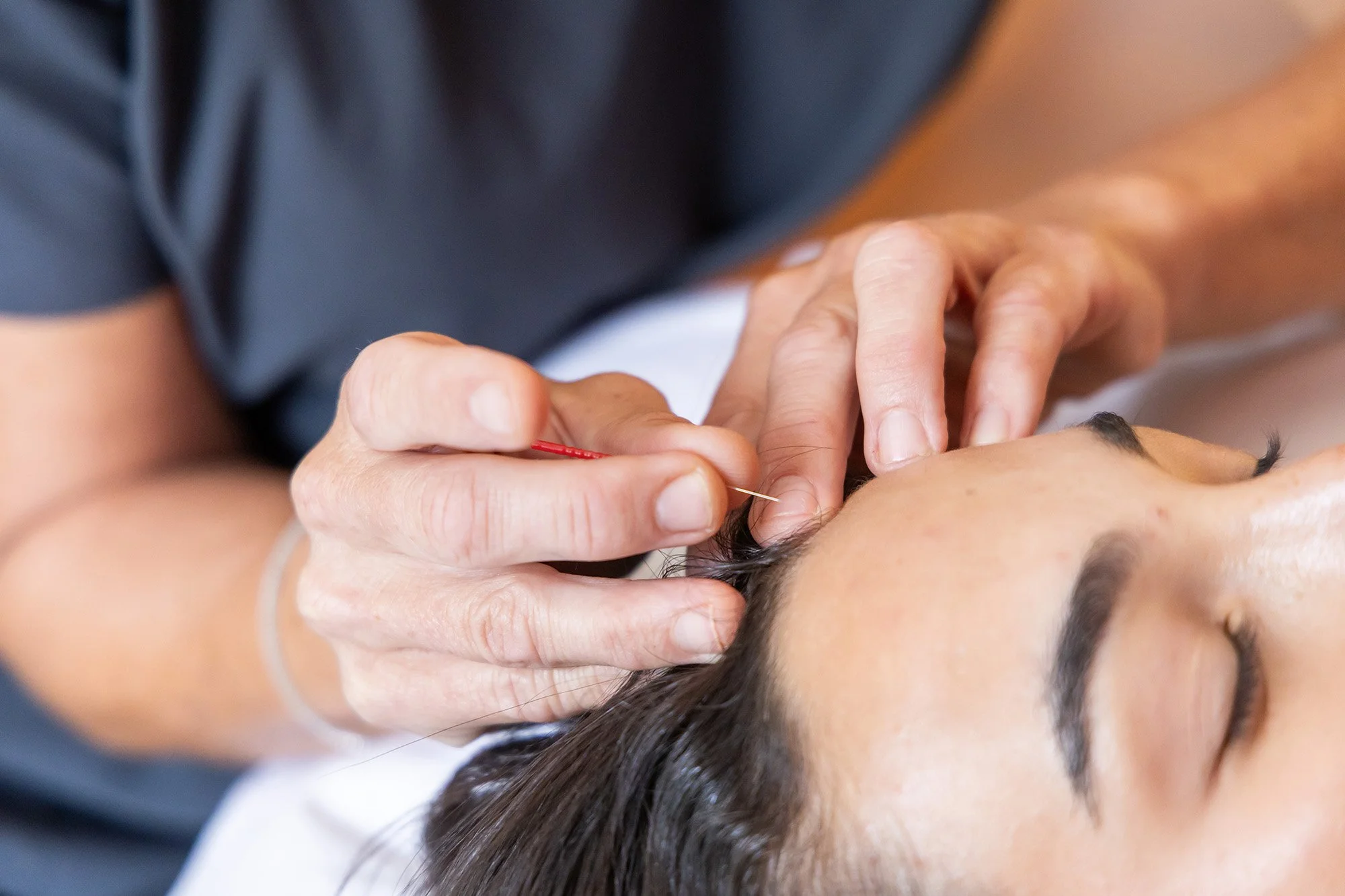 acupuncture-for-pain-walpole.jpg