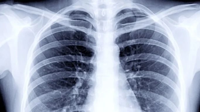 CTDS is awarded a major federal contract to host a new COVID-19 medical imaging resource center