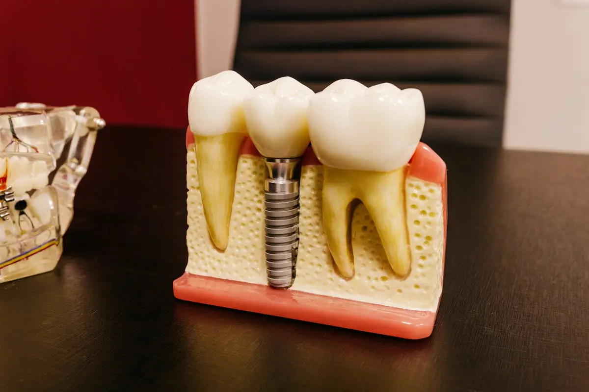 Everything You Need to Know About Dental Implants: Benefits, Process, and Care