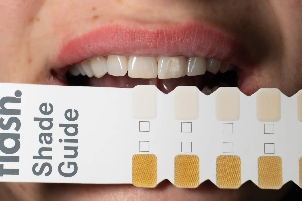 Tooth Whitening Tips for a Dazzling Smile in Miami's Sun