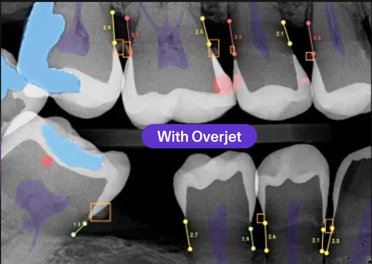 AI-Powered Dental Diagnostics: The Future of Dental Care Is Here