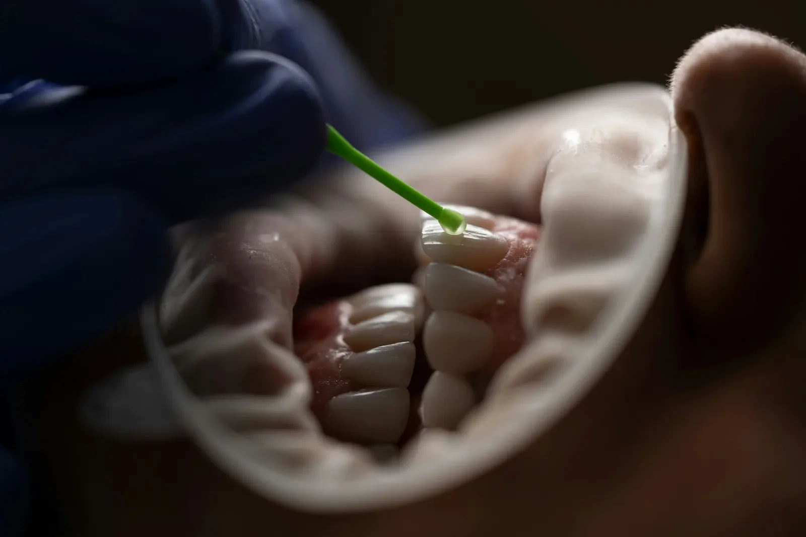 15 Myths About Minimally Invasive Dentistry Debunked