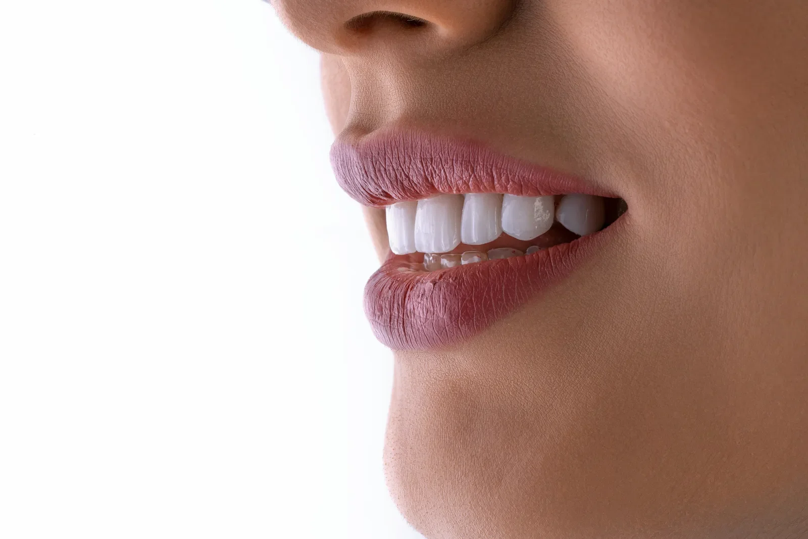 Why Smile Design Is More Than Just Aesthetic in Miami