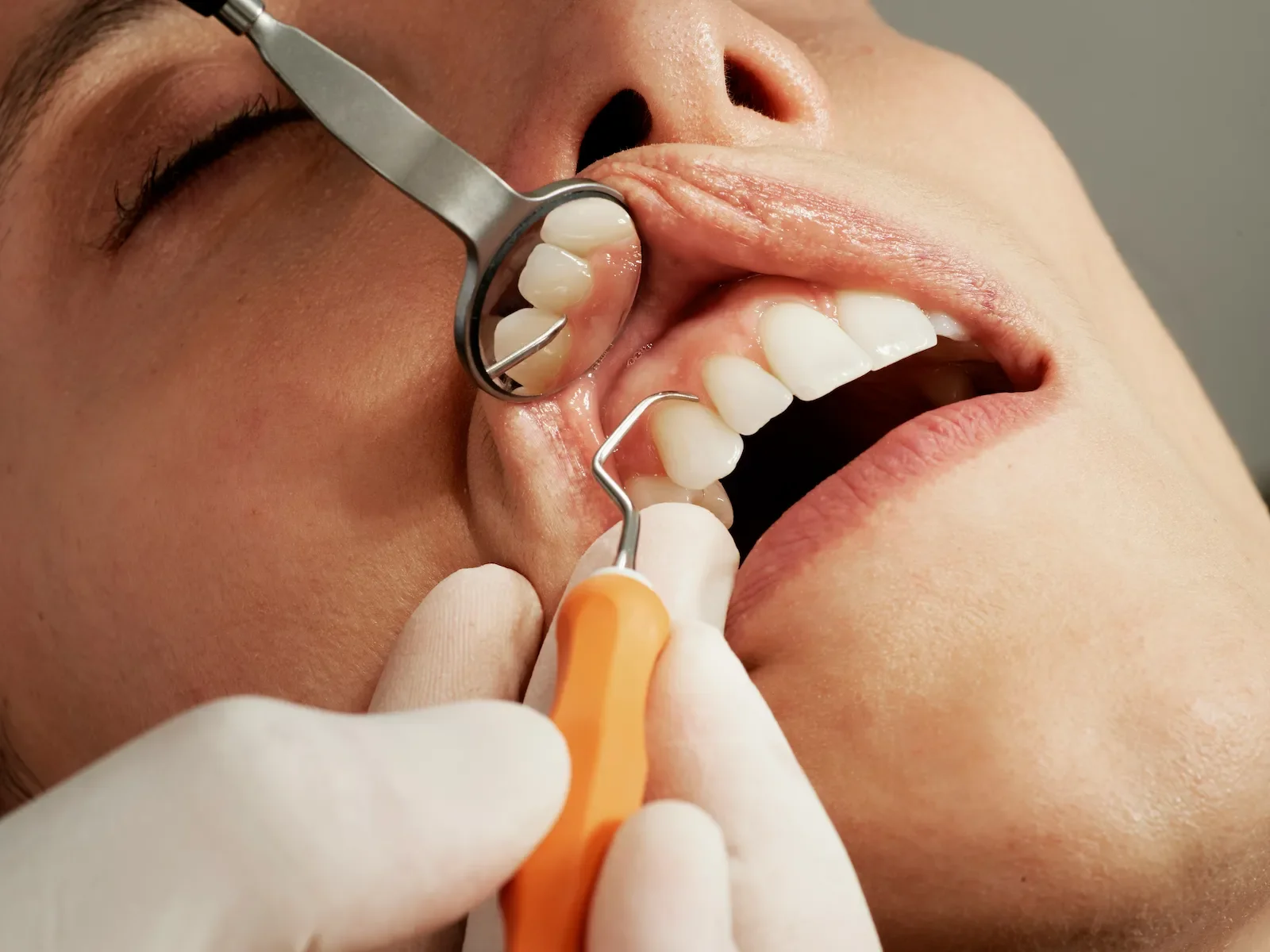 blog-periodontal-disease-creative-toothwork-dentist-kendall-miami.webp