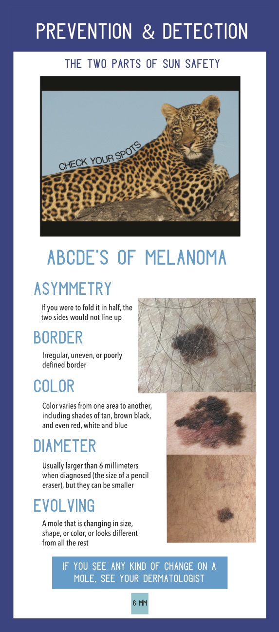 harken-derm-infographic-save-your-skin-abcdes-of-melanoma.jpeg