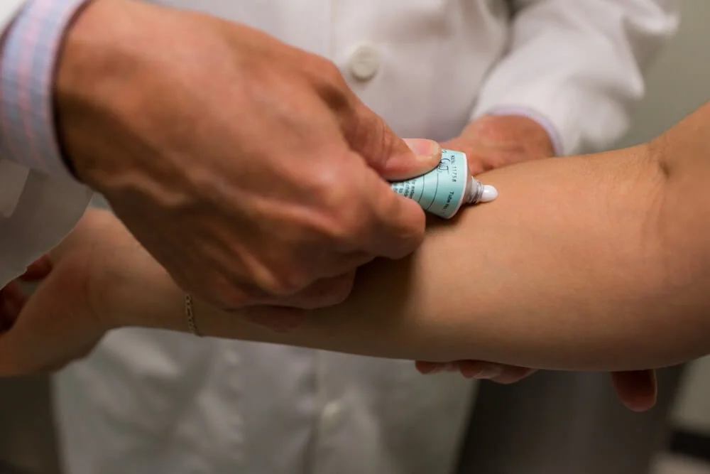 Treatment for Psoriasis in San Diego