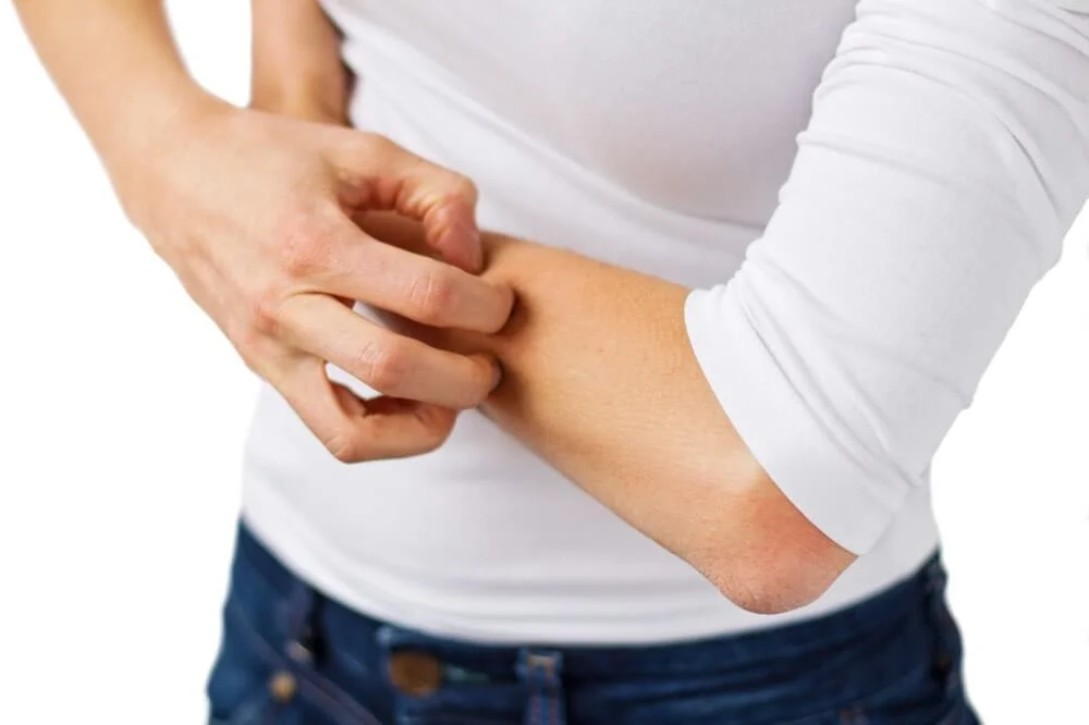 Treatment for Eczema and Dermatitis Treatment.