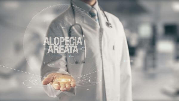 Alopecia Areata diagnosis in San Diego.