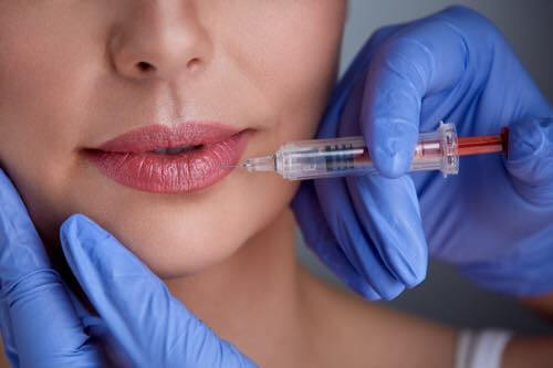 What are the Benefits of Lip Augmentation?