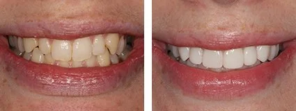 6monthsmiles1.jpg