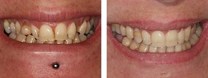 6monthsmiles2.jpg