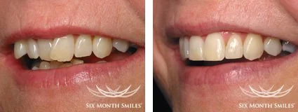 6monthsmiles3.jpg
