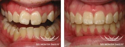 6monthsmiles5.jpg