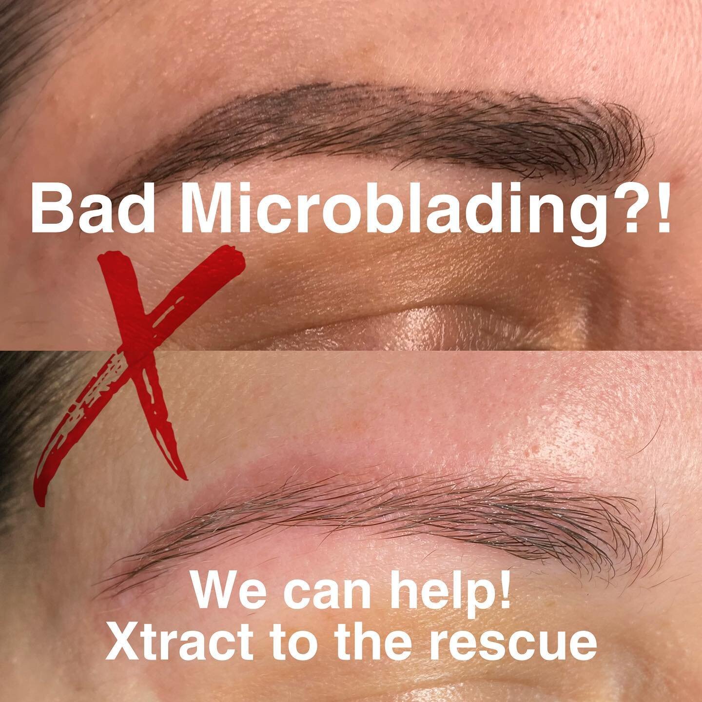 We hear and see bad permanent makeup constantly! It&rsquo;s the sad truth.  And many people don&rsquo;t know there is a solution!
This young beautiful lady was in tears because wanted a natural slightly enhanced brow and rather she received a bold un
