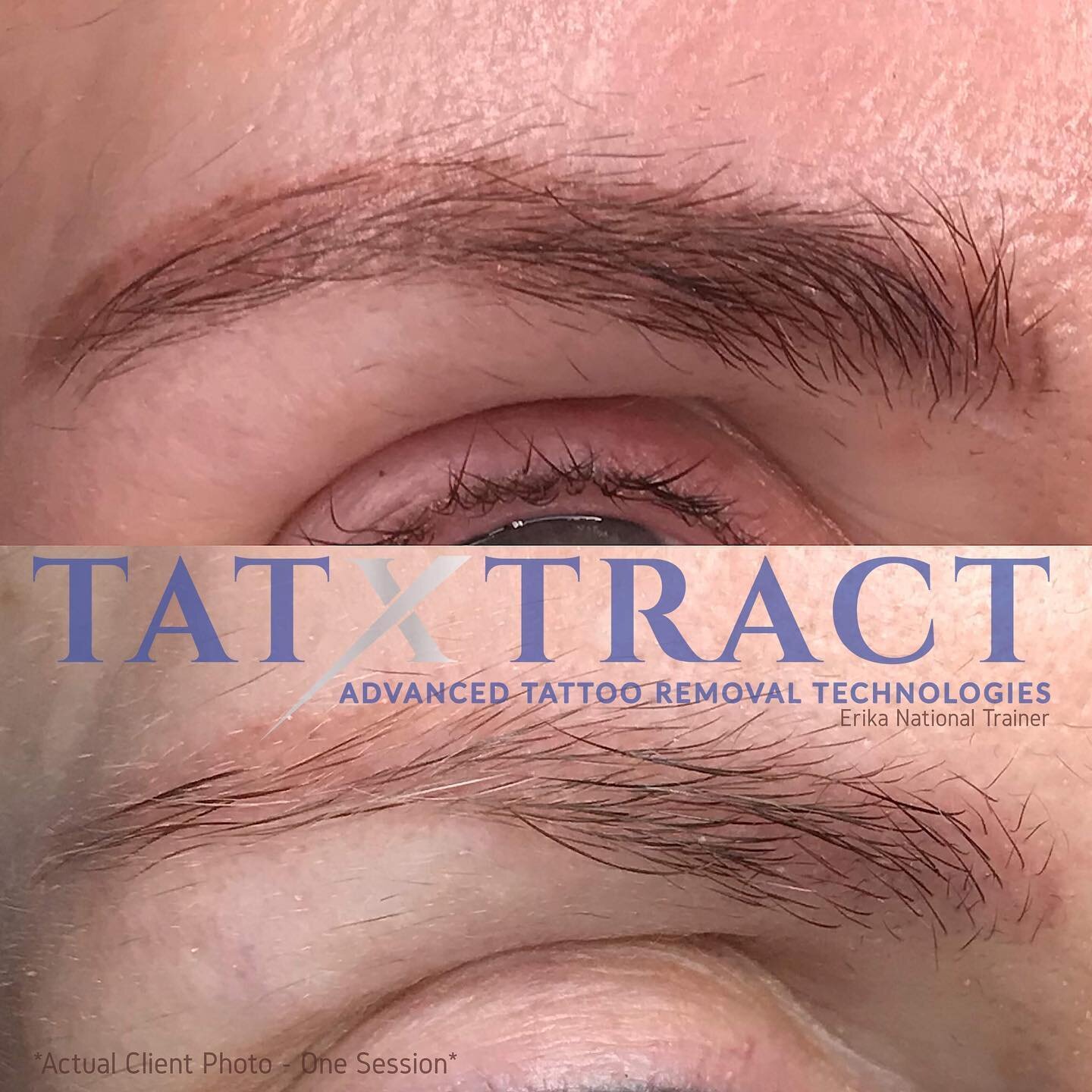 Erika is an international trainer in Tatxtract removal! Bad work got you down? Erika can fix that for you. These results by Erika were accomplished with only ONE session! Individual results may vary.
.
.

Go to www. Microbladingstudiosouthlake.com to