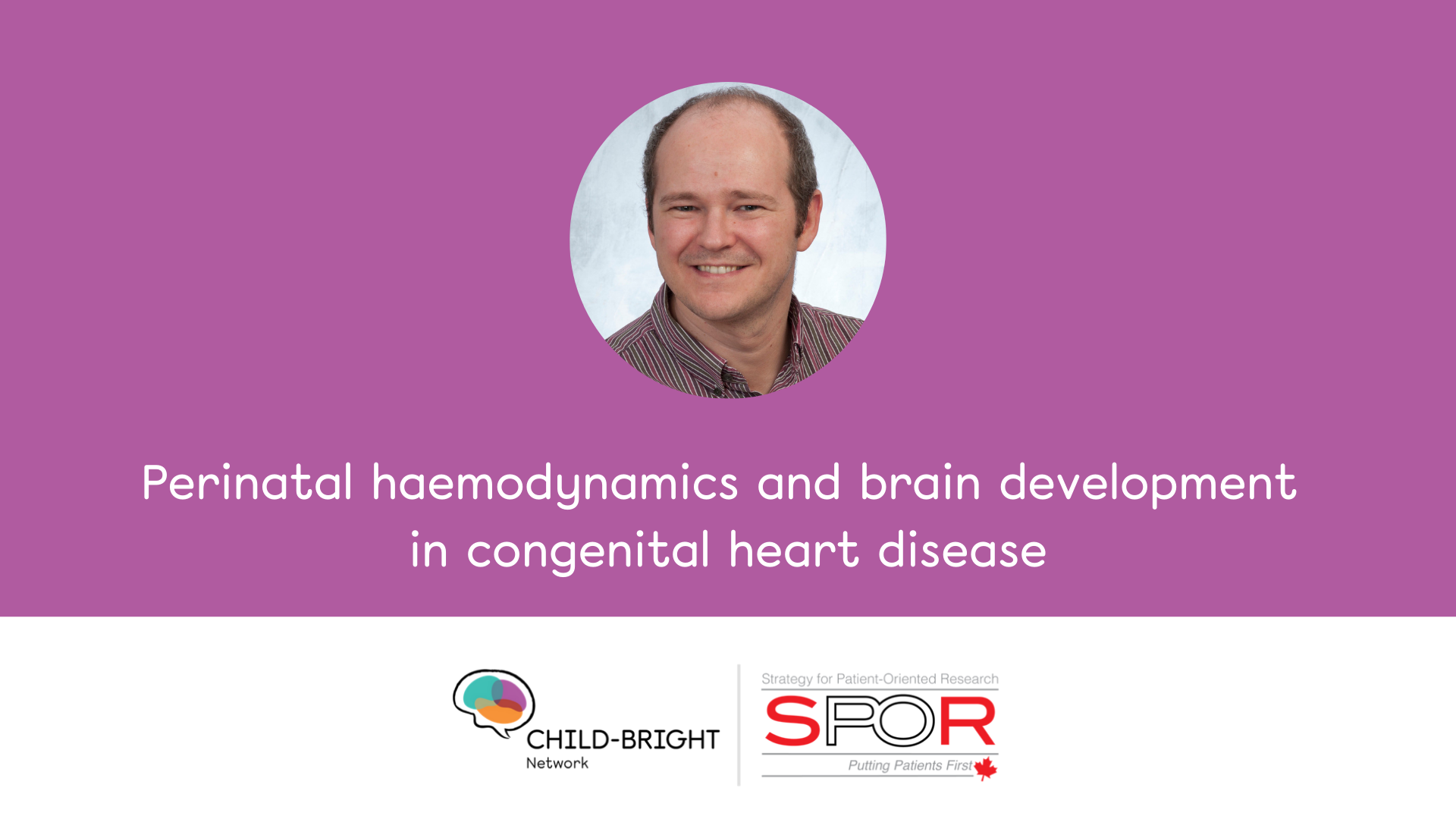 Perinatal haemodynamics and brain development in congenital heart disease