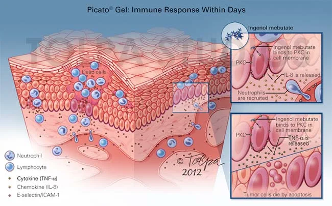 Picato® Gel Mechanism of Action