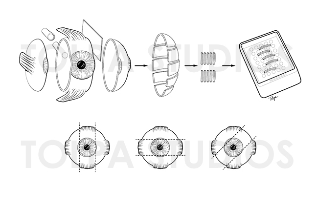 Eye - Common Sections