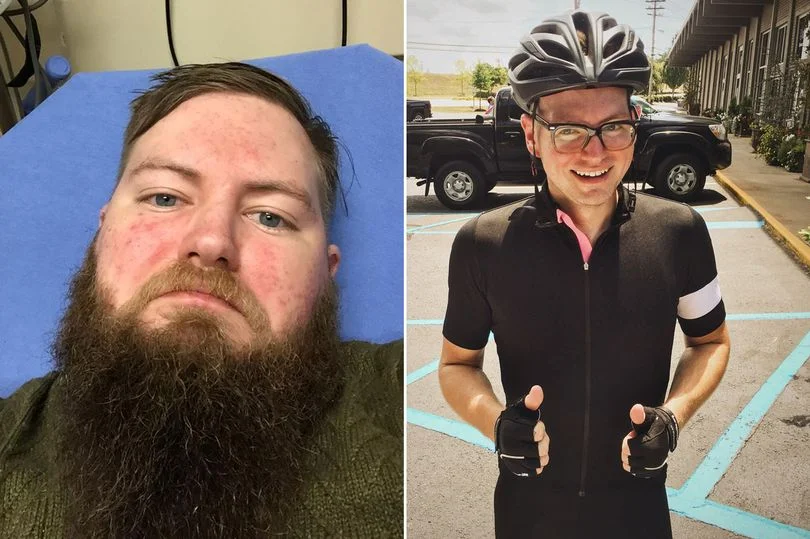 This is NOT me, although at one point in time I was a fat bastard with a beard. This is what a year withot beer looks like