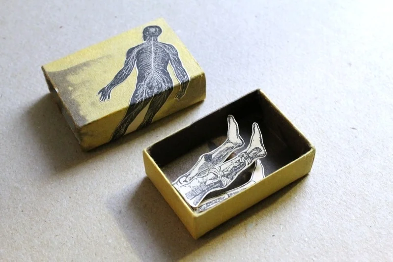 c1-matchbox-art-2011-19-legs-3.jpg