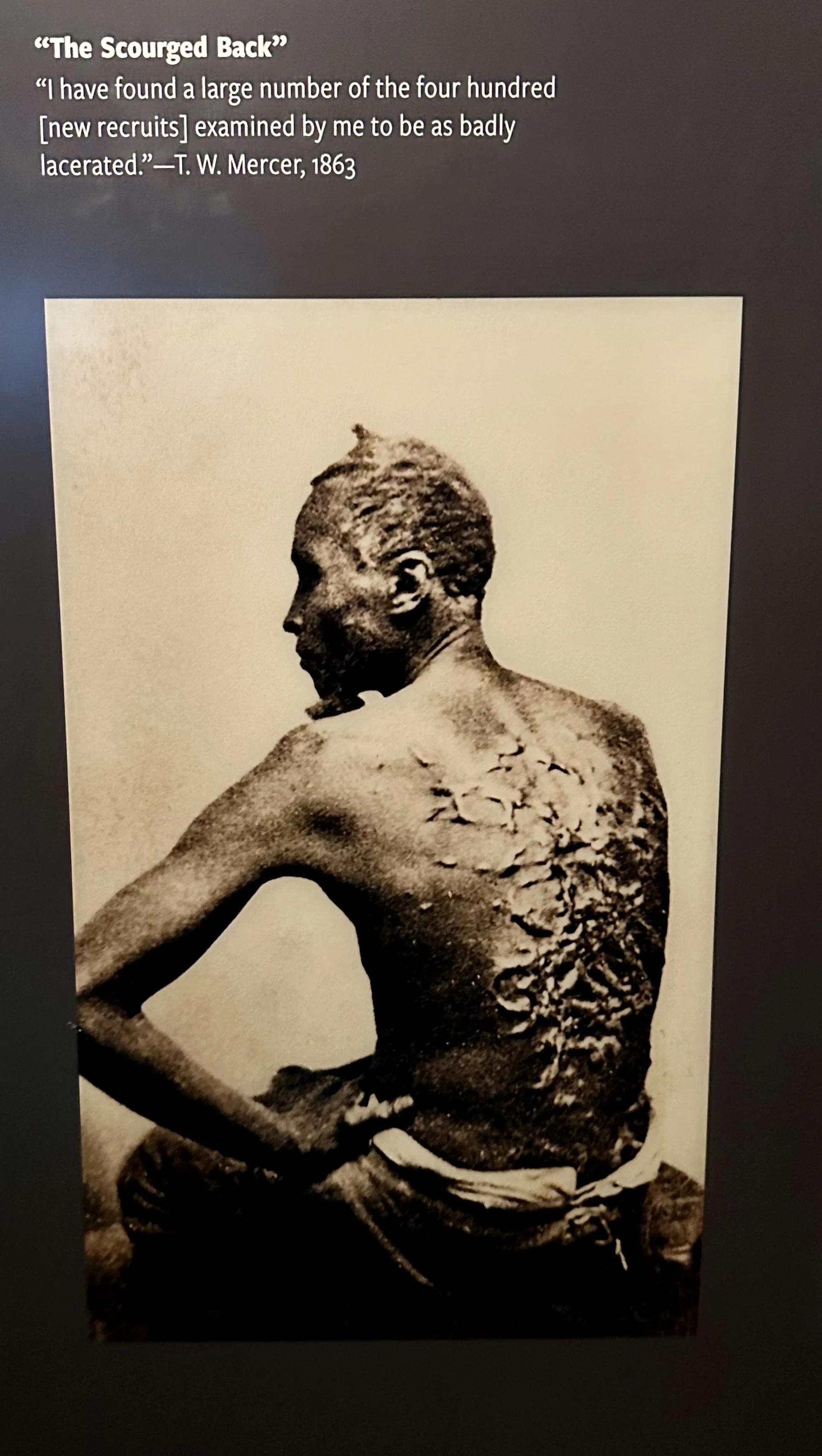 Medical Exam of Civil War Recruit.jpeg