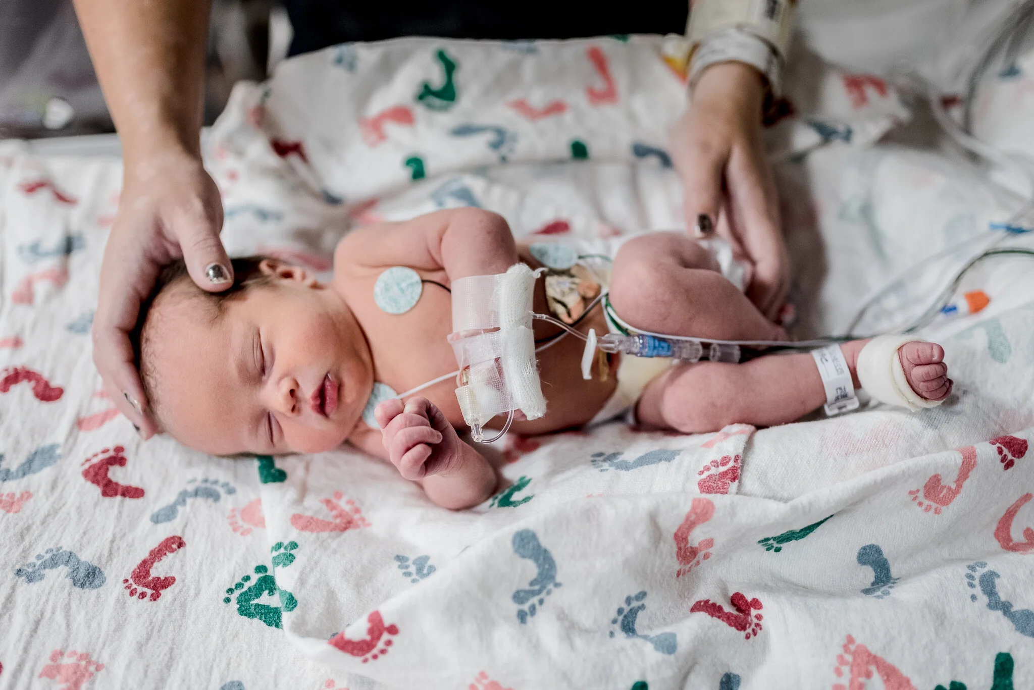 nicu newborn