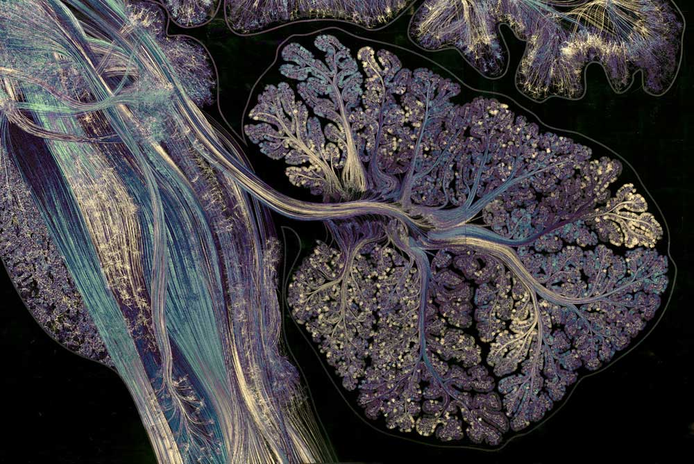 gold-leaf-prints-of-the-human-brain-by-greg-dunn-3.jpg