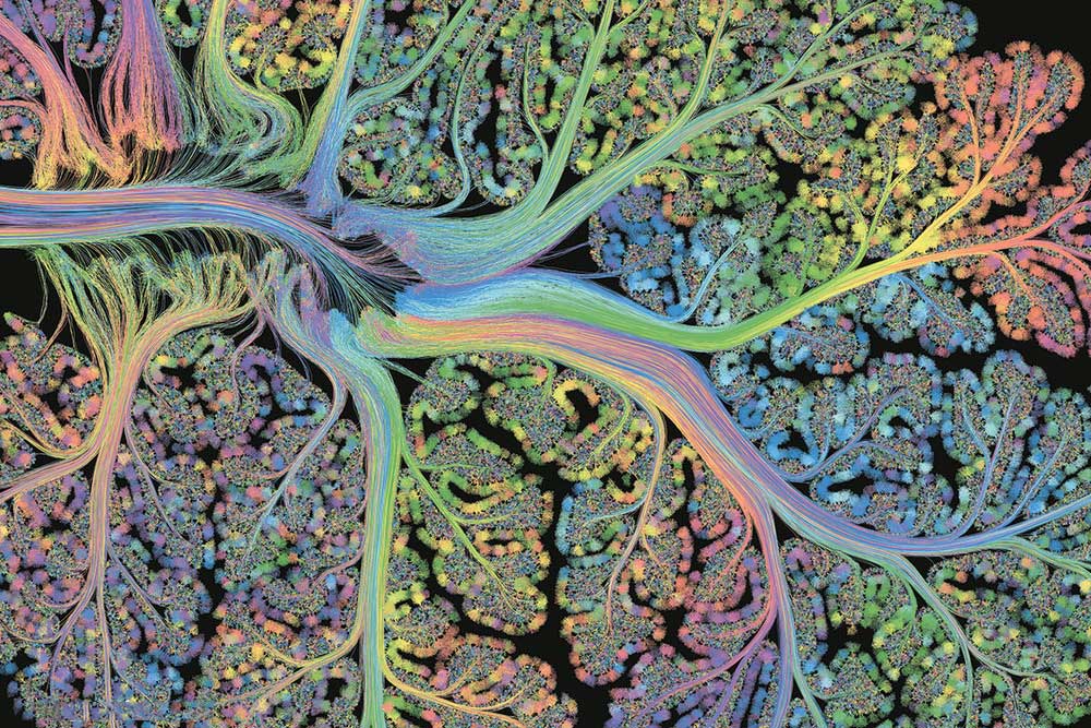 gold-leaf-prints-of-the-human-brain-by-greg-dunn-2.jpg