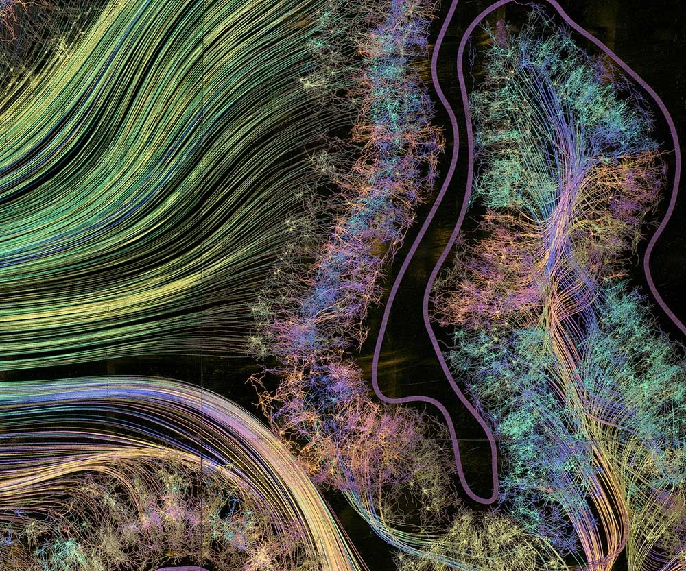 gold-leaf-prints-of-the-human-brain-by-greg-dunn-8.jpg